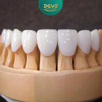 Răng sứ Zirconia có tốt không? Giá bao nhiêu? Nguồn gốc xuất sứ