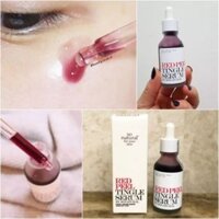 Red Peel Tingle Serum