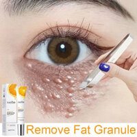 Sadoer Vitamin C Kem Mắt Cho quầng thâm Chống Lão Hóa Chăm Sóc Mắt Loại Bỏ Đường Mịn Các Hạt Mỡ Krim mata Túi Tẩy Mắt