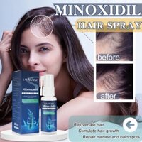Sản phẩm mới Minoxidil chăm sóc tóc phun Serum rắn tóc