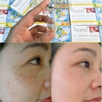 Serum collagen teana