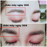Serum dưỡng lông mày - Cho lông mày chắc khỏe, đen mượt