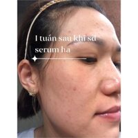 Serum ha plus