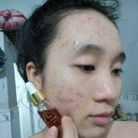 Serum kiều beauty queen