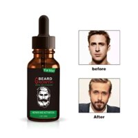 SERUM MỌC RÂU NHANH CHO NAM GIỚI 30ML