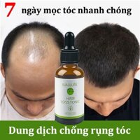 Serum Mọc Tóc Serum Kích Thích Mọc Tóc tinh dầu chăm sóc tóc 30ml Kích thích mọc tóc, giảm gãy rụng chân tóc