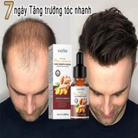 Serum mọc tóc YẾU TỐ GỪNG Kích Thích Mọc Tóc Trong Vòng giảm rụng tóc Trắc bách diệp,làm mềm tóc Và giảm gãy rụng