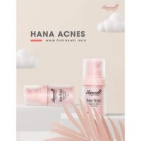 Serum mụn HANA ACNES MINI