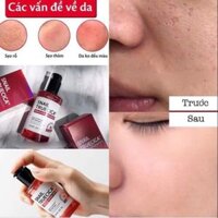 SERUM ỐC SÊN SOME BY MI SNAIL TRUECIXA MIRACLE REPAIR 🐚