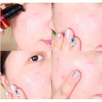 serum ốc sên (some by mi)