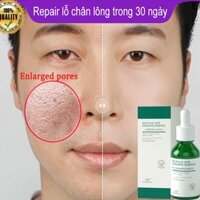Serum se khít lỗ chân lông Sâu Thu Nhỏ Lỗ Chân Lông Cân Bằng Bã Nhờn Làm Sáng Da Da Săn Chắc Mịn Màng Dưỡng Ẩm 30ml