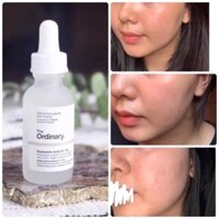 Serum The Ordinary HA 2% + B5