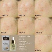 Serum TRI MUN thâm trắng da  LIEN SEO cấp tốc 7 ngay sạch mụn DOCTOR CARE