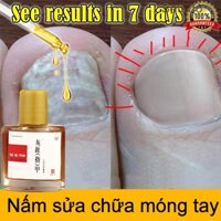 Serum trị nấm móng dưỡng phục hồi móng cải thiện hư tổn móng kích thích mọc móng nhanh chóng nấm móng tay chân