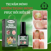 Serum Trị Nấm Móng Tay Chân ELLHOE Hết Sạch Nấm, Bọng Móng, Hư Khoé, Nước Ăn Tay Chân, Dưỡng Cứng Móng
