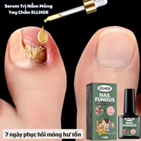 Serum Trị Nấm Móng Tay Chân ELLHOE Hết Sạch Nấm, Bọng Móng, Hư Khoé Nước Ăn Tay Chân Dưỡng Cứng Móng