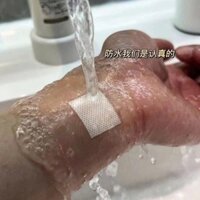 Set 200 băng cá nhân trong suốt chống nước