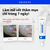 [Skineye] thuốc bôi mụn AC Pure Centella - 20ml,