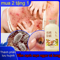 Sữa tắm làm trắng da Xà phòng lưu huỳnh sữa tắm cải thiện mụn/nấm/ngứa hiệu quả an toàn Loại bỏ vi khuẩn 500ml