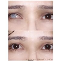 (Tặng ngâm/nhỏ mắt) Kính áp tròng lens 1 năm thẩm mỹ che khuyết điểm IGEL CD P38
