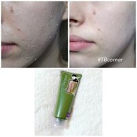 Tẩy da chết tràm trà Naruko cho da dầu mụn nhạy cảm