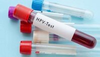 Test thử HPV