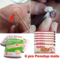 Thạch Cao Mụn Cóc/Cá Mắt/Nội Dung 6/Mụn Cóc Bao/Cá Tuyết