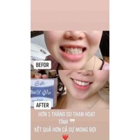 THAN hoạt tính trắng răng