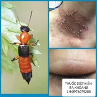 Thuốc diệt kiến ba khoang,muỗi,côn trùng FENDONA 10SC 50ml [chính hãng]