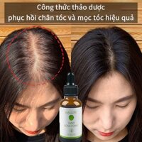 thuốc mọc tóc serum Giảm rụng tóc bảo vệ chân tóc kích thích mọc tóc nuôi dưỡng tóc hư tổn giúp tóc đen trở lại