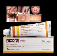 Thuốc trị nấm, ngứa, lang ben Nizo ral Cream Ketoconazole Thái Lan