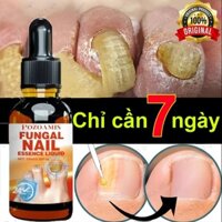 【Thương hiệu Hàn Quốc】Serum Trị Nấm Móng Tay Chân Hết Sạch Nấm,Móng quặp nặng, Bọng Móng, móng tay móng chân bị cuốn món