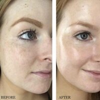 Tinh chất dưỡng da Alpha Arbutin 2% + Hyaluronic Acid thương hiệu The Ordinary .