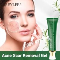 🍀Tinh Chất Gel Trà Tràm Loại Bỏ Mụn, Liền Sẹo Và Dưỡng Trắng Da 30g.🍀