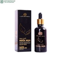 Tinh chất ngừa mụn  FREESHIP  Serum trị mụn đông y MAGIC SKIN 80ml