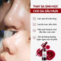 Tinh Chất Peel Da Red Peel Tingle Serum Hàn Quốc 11ml tái tạo da sạch sáng & căng bóng