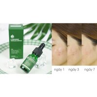 Tinh Chất Rau Má Hỗ Trợ Giảm Mụn Caryophy Portulaca Ampoule