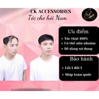 Tóc che hói nam tóc thật 100% che hói phủ bạc