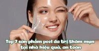 Top 7 sản phẩm peel da trị thâm mụn tại nhà hiệu quả, an toàn