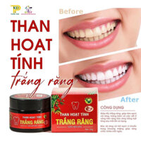 trắng răng than hoạt tính
