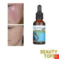 Treeannsea Dầu Tamanu Madagascar Madagascar Tamanu Oil 30ml dầu dưỡng dầu dưỡng da mặt facial oil tinh dầu dưỡng da