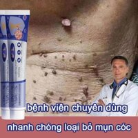 Trị mụn cóc kem loại bỏ mụn cóc Loại bỏ mụn ruồi trâu lấy lại làn da tự tin căng đẹp mụn cơm cứng đầu nhanh chóng