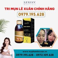 Trị mụn đông y Lê Xuân