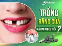 Trồng răng cửa hết bao nhiêu tiền?			Để lại bình luận