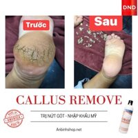 Ủ Mềm chà gót hết nứt nẻ DND (USA) 355 ml