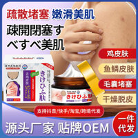 Up Iwai Shihiro Tẩy Tế Bào Chết Ngỗng Tóc Follicles Keratin Cá Cân Da Rắn Kem Lột Khô Bán Hàng Trực Tiếp / 2.28 Xoài