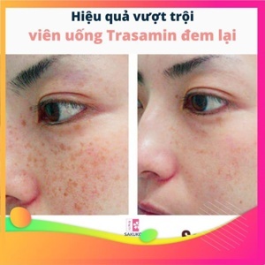 Viên uống trắng da, mờ nám Cinal C 100 viên