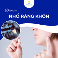 Voucher Nhổ răng khôn tại nha khoa Top Smiles