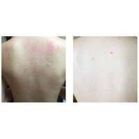 Xịt hỗ trợ giảm mụn lưng, toàn thân Not4U Clear Body Mist 200ml [Dành cho cả nam & nữ]