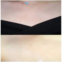 Xịt hỗ trợ giảm mụn lưng, toàn thân Not4U Clear Body Mist 200ml [Dành cho cả nam & nữ]